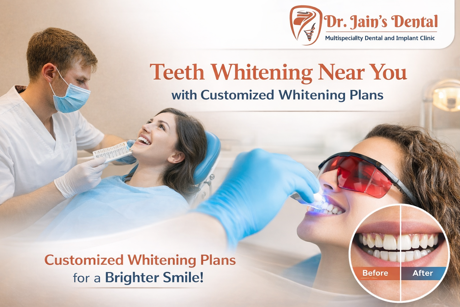 Teeth Whitening Near You with Customized Whitening Plans
